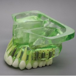 Tandheelkundig model# 2015 01 - Implantaatmodel voor de bovenkaak met sinus