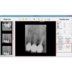 Digitale USB-type tandheelkundige röntgensensor met hoge resolutie Rvg HDR 500