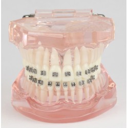 Tandheelkundige tanden Malocclusie Correct met metalen beugel Standaardmodel M3001