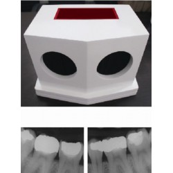 Automatische tandheelkundige ontwikkelaar van röntgenfilmprocessoren