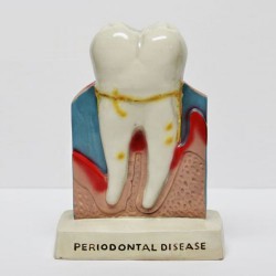 Tandarts tandheelkundige tanden orale anatomie onderwijs staande decoratie model figuur