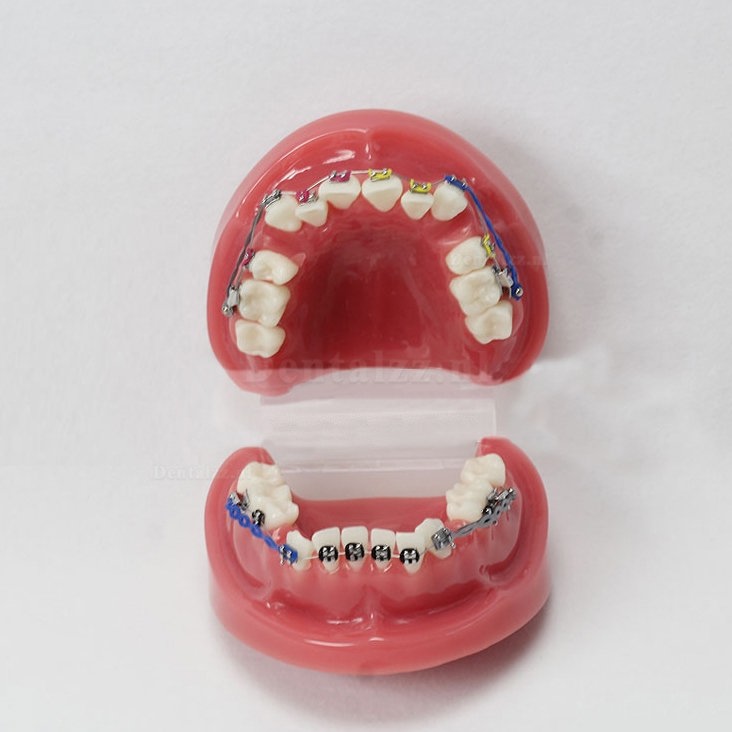 Tandheelkundige tanden Malocclusie Correct met tandenbeugel Standaardmodel M3005