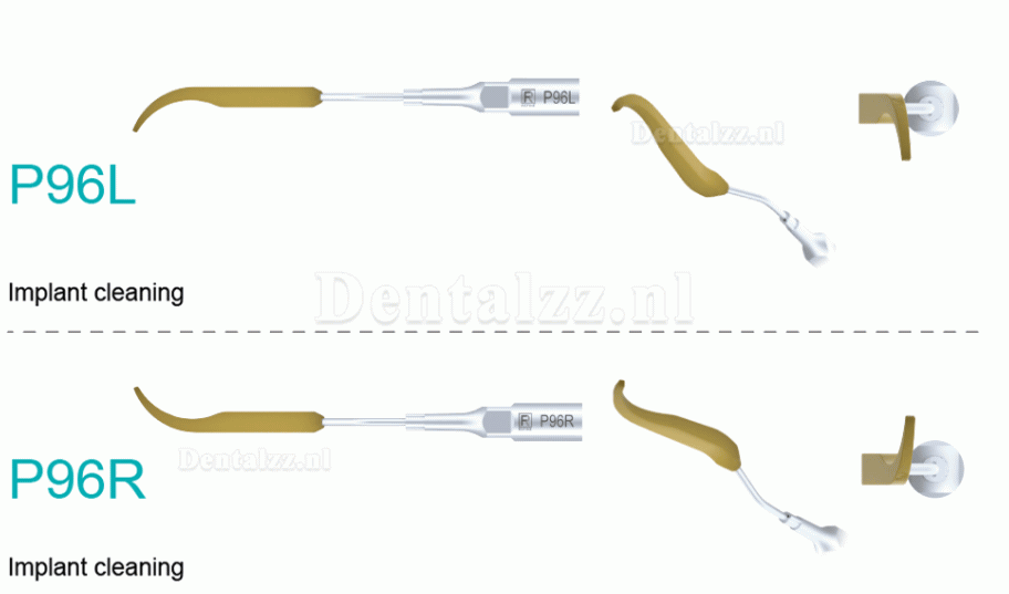5Pcs Ultrasoon tips voor implantaatreiniging P90 P94 P95 P96L P96R compatibel met REFINE EMS MECTRON Woodpeaker