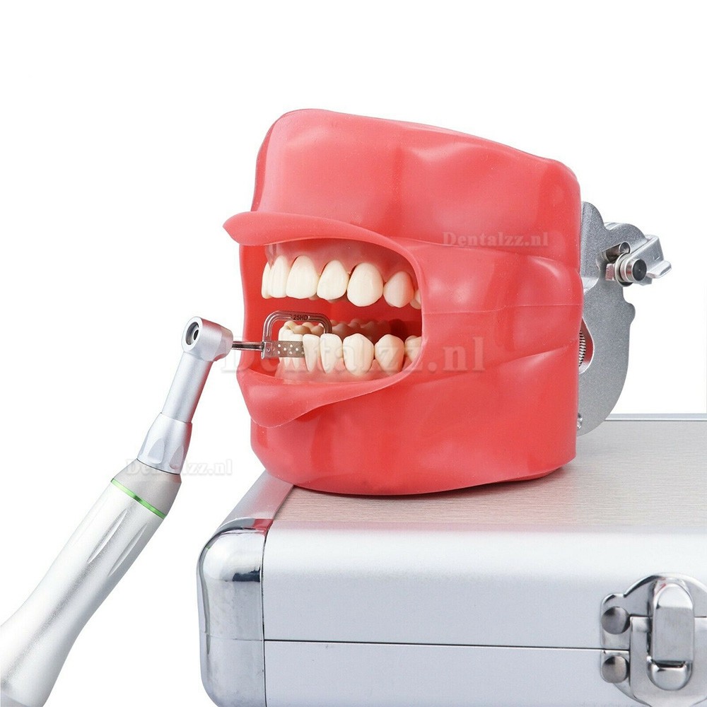 Groen Hoekstuk 4:1 Orthodontische Heen en Weer Gaande Strippen IPR